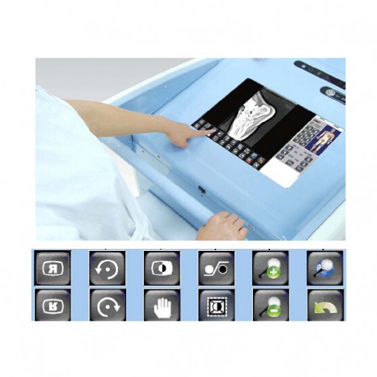 Advanced High Frequency Mobile Digital Radiography System