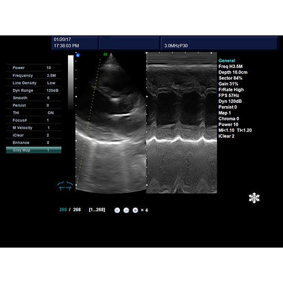 High Clear Imagine Laptop 4D Color Doppler Ultrasound and Scanner System