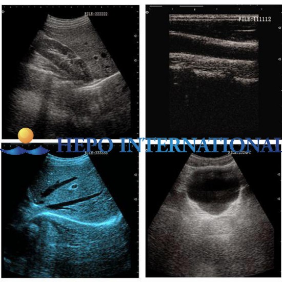 Medical High End White and Black Laptop Ultrasound Scanner