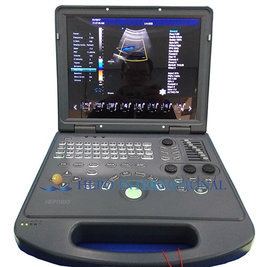 Clinic Popular Laptop 4D Color Blood Flow Ultrasound Doppler