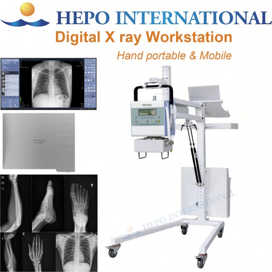 Medical Portable High Frequency X Ray Machine for Human Usage