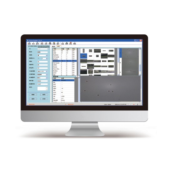 CE Certified Advanced Auto Urinary Sediment Analyzer