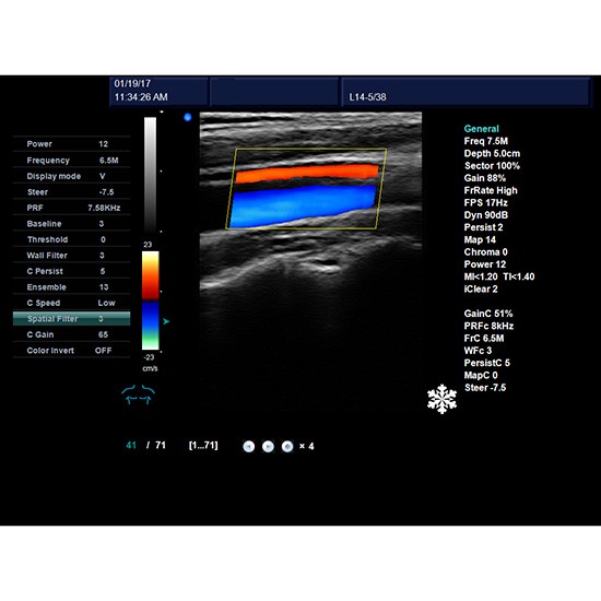 Clinic Popular Laptop 4D Color Blood Flow Ultrasound Doppler