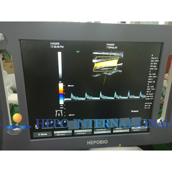 Hospital Popular Full Digital Color Doppler Ultrasound Diagnostic System With CW