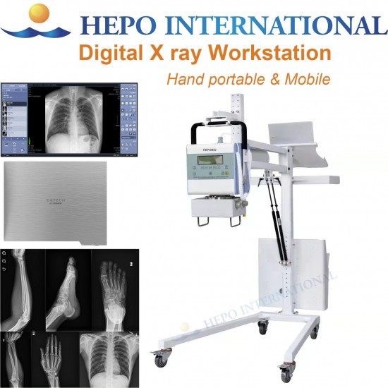 Portable Medical Digital Radiography X Ray Workstation